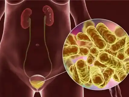 Dayagram ng sistemang pantinig at kolonasyon ng bacteria