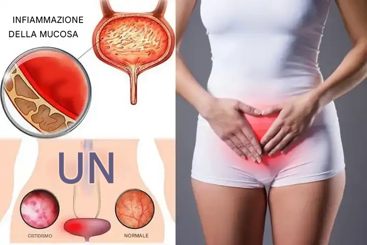 Klinikal na tanaw sa ibabang tiyan at kaugnay na dayagram